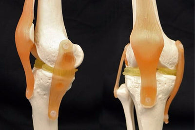 Saintis Cipta Dakwat Bio Hibrid Percetakan 3D Untuk Kecederaan Kartilaj Pada Lutut